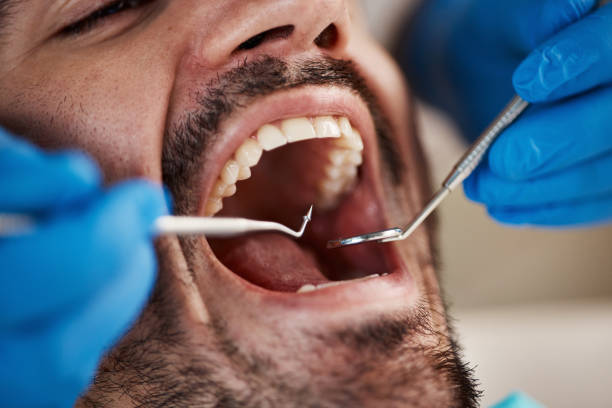 Best Emergency Treatment for Oral Infections in Sugar City, ID